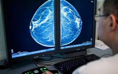 What Your Mammogram Can Tell You About Your Cardiovascular Health