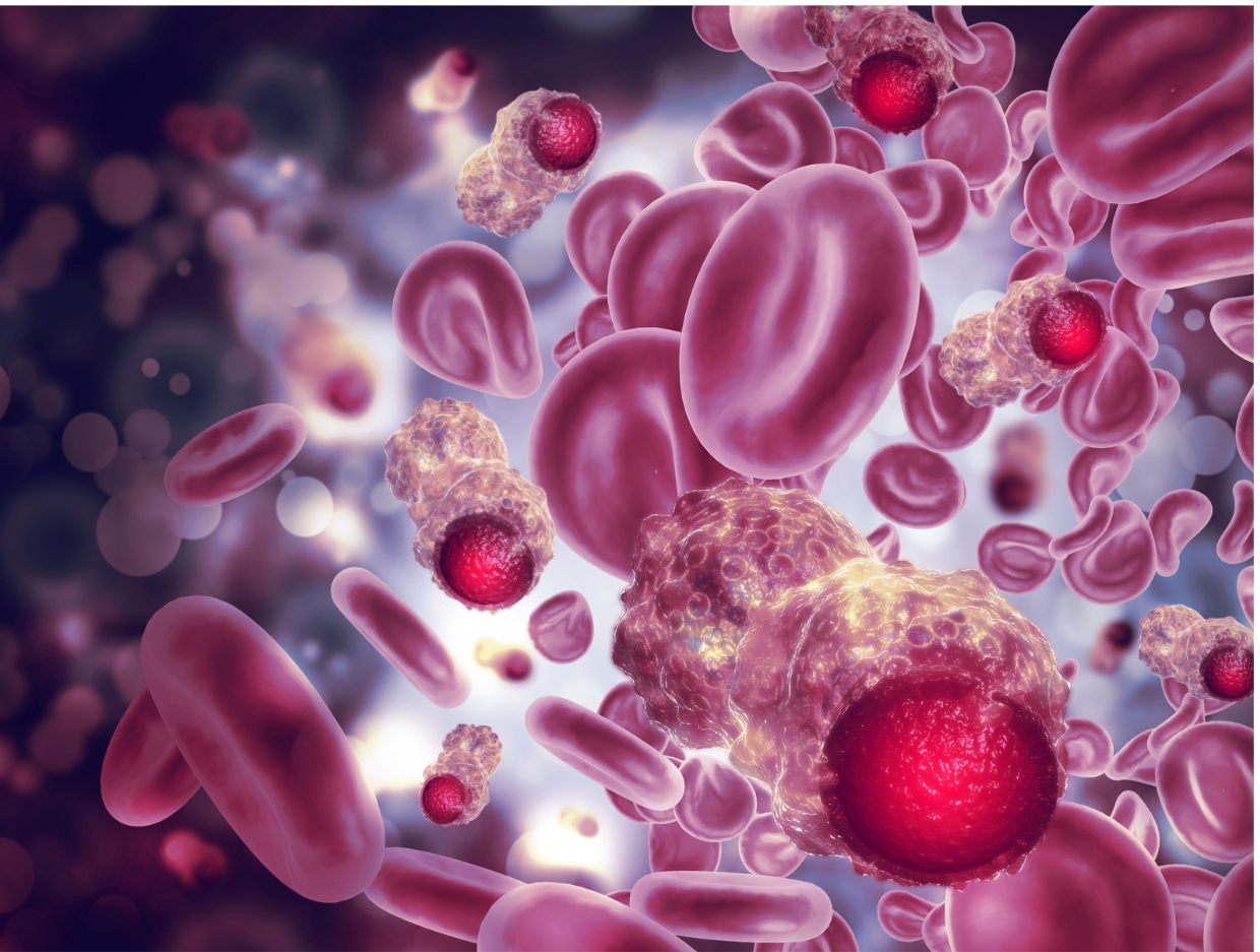 How Cancer Cells Travel To New Tissues And Take Hold